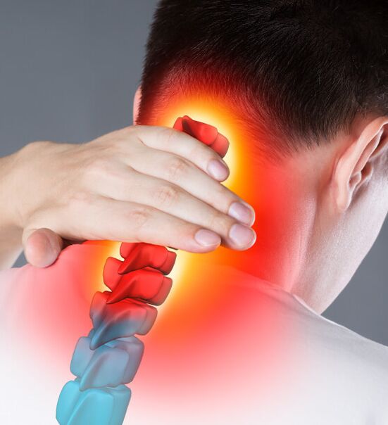 Objawy osteochondrozy szyjnej