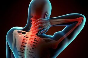 Osteochondroza szyjka macicy