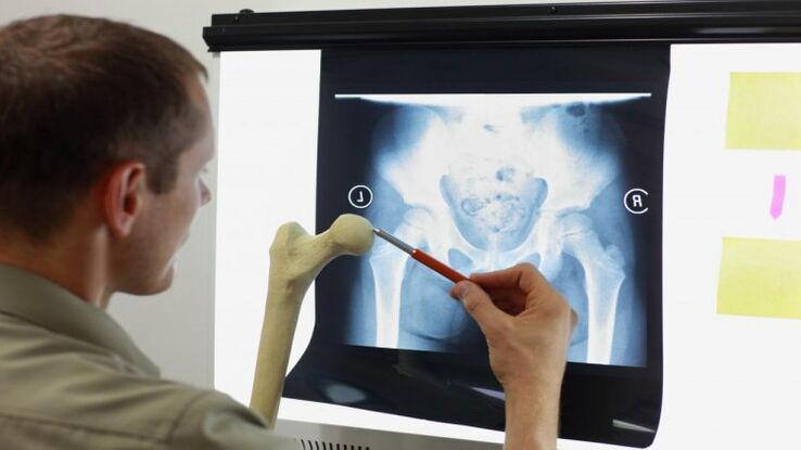 Lekarz bada prześwietlenie pod kątem artrozy stawu biodrowego