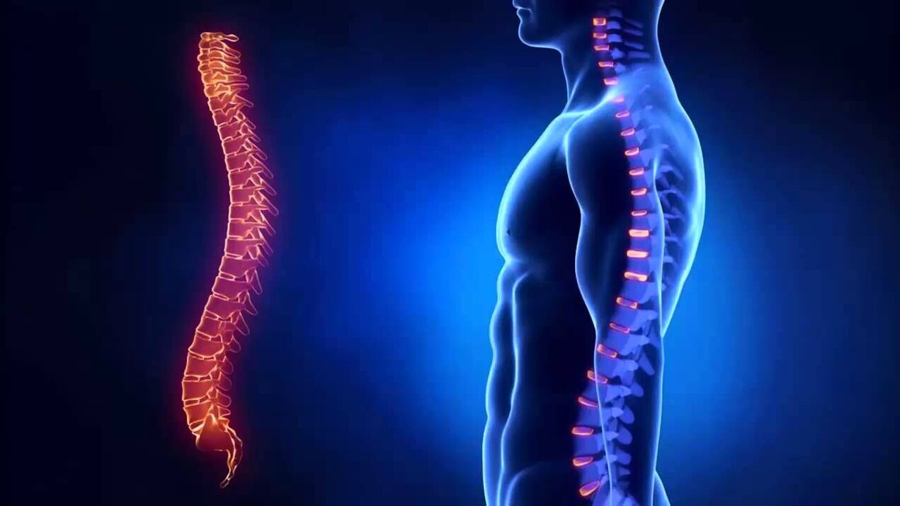 Osteochondroza jest klasyfikowana według części kręgosłupa, w których rozwija się choroba.